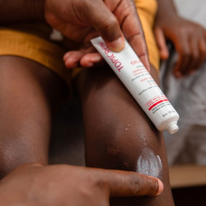 OUDERS-DIE-GENEZENDE-CRÈME-OP-DE-KNIE-VAN-EEN-KIND-AANBRENGEN