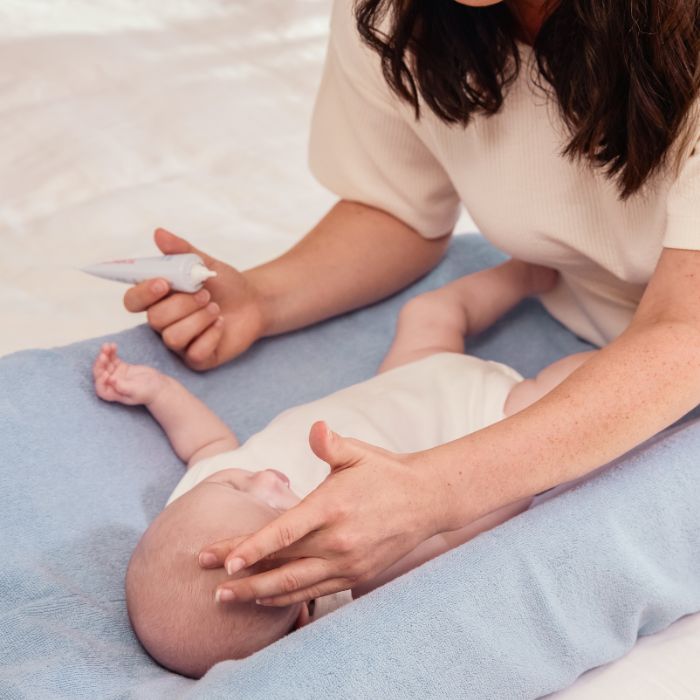 Les croûtes de lait : causes et solutions pour soulager votre bébé
