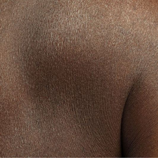 La peau sèche : Comment la reconnaître et en prendre soin?