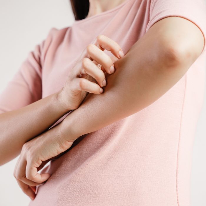 EEN-VROUW-KRABT-AAN-HAAR-ARM