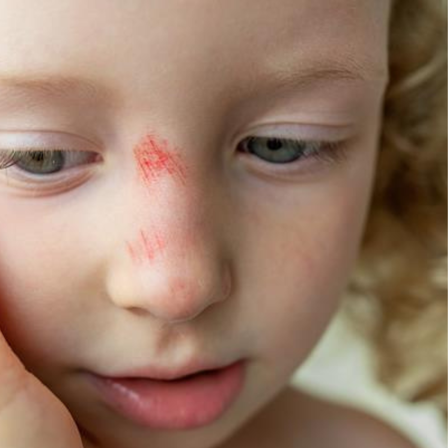 EGRATIGNURE-VISAGE-ENFANT