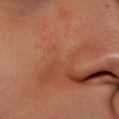 Crème émolliente visage AVANT*